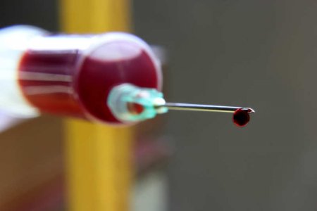 Photo of Учёные создали жидкий бинт, который поможет справиться с внутренним кровотечением