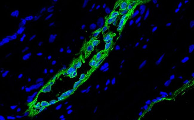 Photo of Учёные открыли новую разновидность стволовых клеток