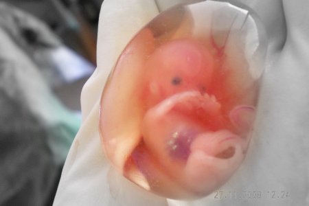Photo of Искусственно созданные эмбрионы помогут установить причины не вынашиваемости беременности