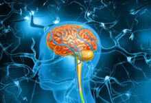 Photo of Неврит: причины, симптомы, лечение